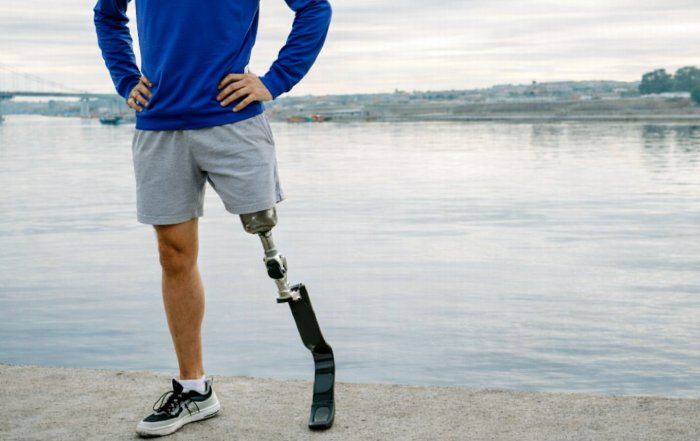 Article Image for Advances in Prosthetic Technology for Athletes