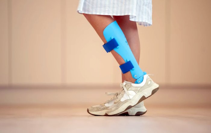 Article Image for Wearable Biomechanics: The Next Frontier in Injury Prevention